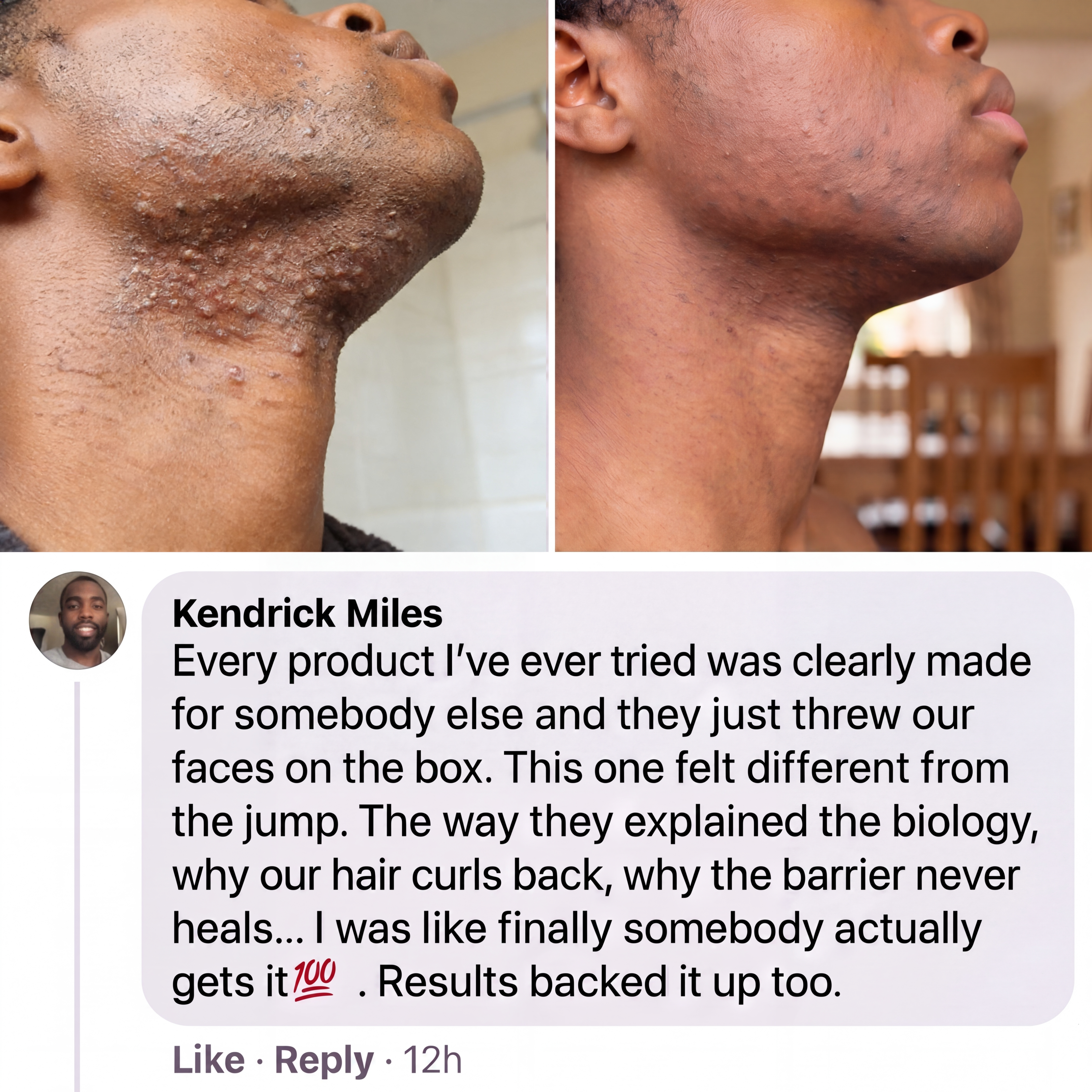 ClearKind™ The Barrier Reset Formula