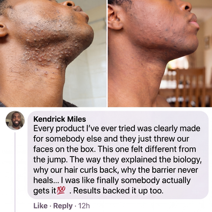 ClearKind™ The Barrier Reset Formula